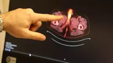 Tıp literatürüne giren son isim Diyarbakır'dan! Penisi alındı