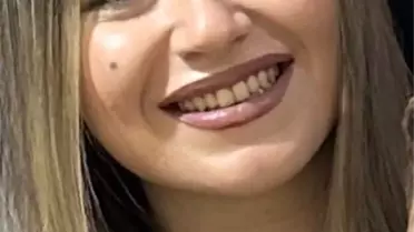 Kartal'da Hemşire Pencereden Düştü