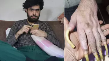 Türkiye'nin konuştuğu Barış'ın son hali! 25 yaşını kutladı, türkü bile söyledi