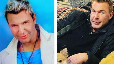 Kuşum Aydın estetik sonrası son halini paylaştı! Değişimi gündem oldu