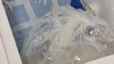 Sahipsiz Köpekler Adamın Parmakını Kopardı