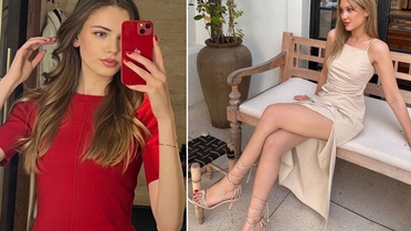 Berke Özer’in model sevgilisi doğal güzelliğiyle gündemde 