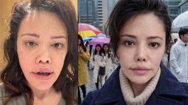 “Kore’de yüz nakli oldum” demişti… Didem Ceran: Bebeksiliğim yapay zeka değil