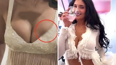 Milyonlarca hayranı bu sorunun cevabını arıyor: Kylie Jenner’ın silikonu mu patladı?