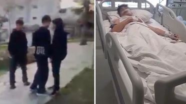 Yaşıtını bıçakla ağır yaralayan çocuk saldırı anını da kayda aldırdı