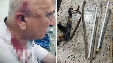 Kerkük'te kaçak yapı yıkımı sırasında kaymakama bıçaklı ve sopalı saldırı