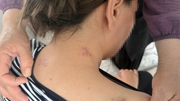 Eşinin saldırdığı kadın 17 bıçak darbesi aldı, ölü numarasıyla kurtuldu
