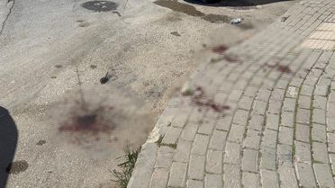 Sosyal Medya Fenomeni Bıçakla Yaraladı