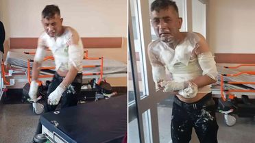 Engelli vatandaşı benzin döküp yakan vicdansıza verilen ceza belli oldu