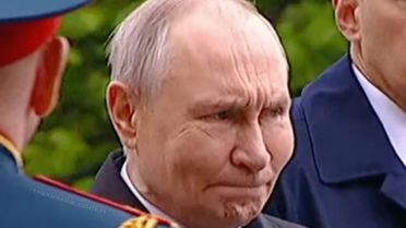 Putin’in yüzündeki 'Korkutan' şişlik: Hastalık mı, yoksa botoks mu?