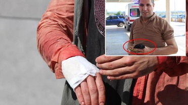 '13 dakikada kurbanı keserim' diyen acemi kasap kendini kesti