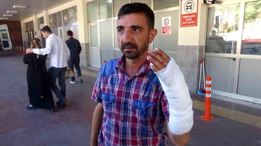 Şanlıurfa'da 'acemi kasap'lar hastanelik oldu: 232 yaralı