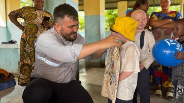 Albino Çocuklara Bayram Sevinci