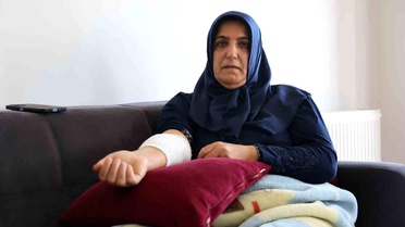 Elazığ'da Köpek Saldırısı: Bir Kadın Yaralandı
