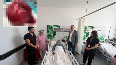 Niğde'de bir hastanın vücudundan 7 kiloluk tümör çıkarıldı