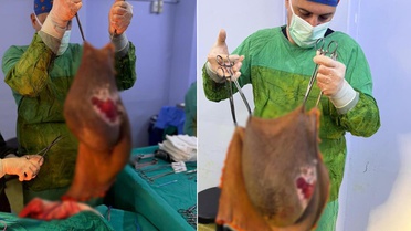 Bu kitle bir insanın karnından çıktı! Doktor tek başına kaldıramadı