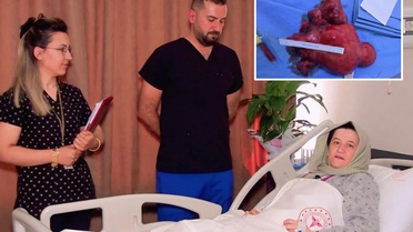 Şanlıurfa'da Dev Miyom Ameliyatı Başarıyla Gerçekleşti