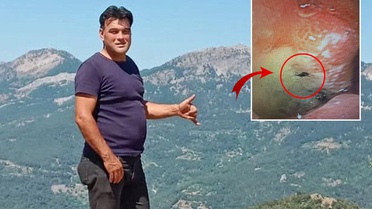 Kabus gibi olay! Midesinden canlı böcek çıkarıldı