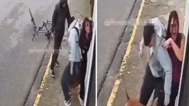 Genç kadın, pitbull köpeğinin saldırısına uğradı