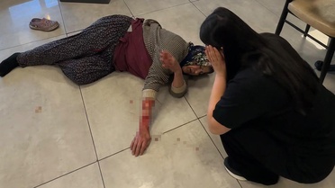 Saldırgan köpek kadının kolunu kopardı