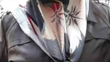 Yangında Yaralanan Kadın Hayatını Kaybetti