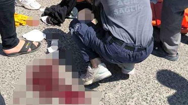 Motosikletten düşen kadın ağır yaralandı