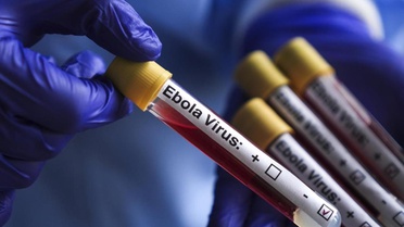 Kongo'da ebola salgını: 1155 vaka, 304 ölüm