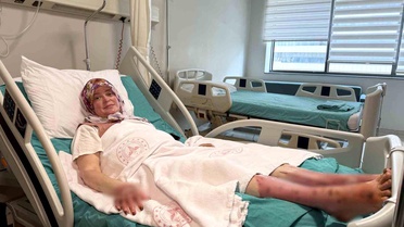 Karavanda Patlama: Aile Yok Olma Tehlikesiyle Karşılaştı