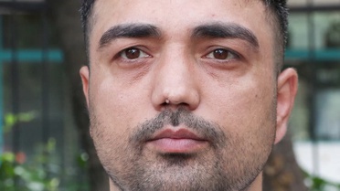 Burun ameliyatına girdi, başına gelmeyen kalmadı! İşini bile kaybetti