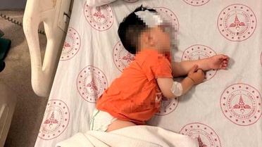 Şanlıurfa'da Sokak Köpekleri 1,5 Yaşındaki Çocuğu Saldırdı