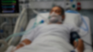 Güney Kıbrıs'ta saldırıya uğrayan 47 yaşındaki Türk vatandaşı entübe edildi