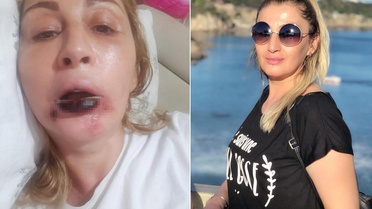 Güzelleşeyim derken bu hale geldi