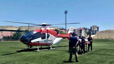 İş Kazasında Parmak Kopması