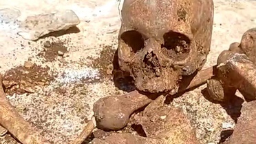 Hekimhan'da İnşaatta İnsan Kemikleri Bulundu