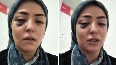 Bir annenin yardım çığlığı: Ben yaşıyorken hakkımı savunun