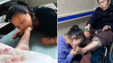 7 yıl boyunca eşinin parmaklarını ısırdı! Doktorların bile beklemediği mucize gerçek oldu