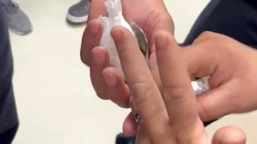 Adana'da Yüzük Sıkışmasına İtfaiye Müdahalesi