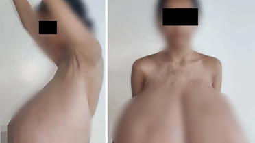 13 yaşında başladı! Göğüsleri vücut ağırlığının dörtte birine ulaştı