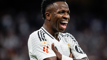 Vinicius Junior estetik yaptırdı, bambaşka birine dönüştü