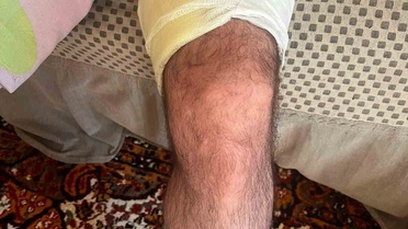 Arazi Anlaşmazlığı Kanlı Bitti: 1 Yaralı
