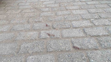 Damat Kayınpederi Tarafından Tüfekle Vuruldu