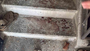 Eskişehir'de Kavga: 2 Polis ve 7 Yaralı