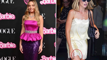 Barbie yıldızı Margot Robbie'nin bacağındaki morluk hayranlarını endişelendirdi