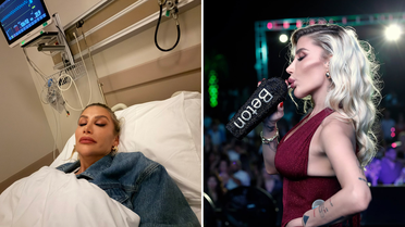 İrem Derici’nin çene görüntüsü şaşırttı! Herkes dolgu sandı ama gerçek ortaya çıktı