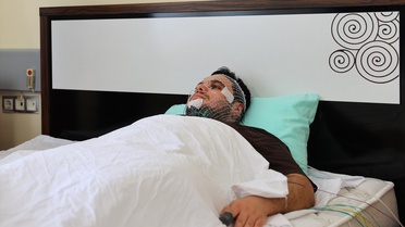 OMÜ Uyku Ünitesi'nde Kişiye Özel Tedavi