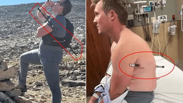 Mucize kurtuluş! Bu halde 16 kilometre yürüdü
