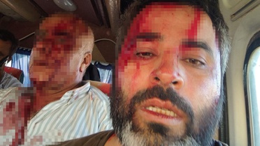 Meydan savaşı gibi kavga: Sopaları kılıç, taşları ok gibi kullandılar