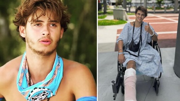 Survivor'da bacağını kaybeden yarışmacıdan yeni paylaşım: Yeni hayatına alışmaya çalışıyor