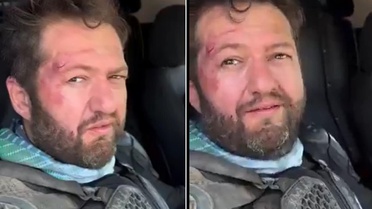 Fenomen Ömer Başdoğan motosiklet kazası geçirdi