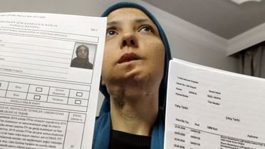 Serap Öztürk'ten Yardım Çağrısı